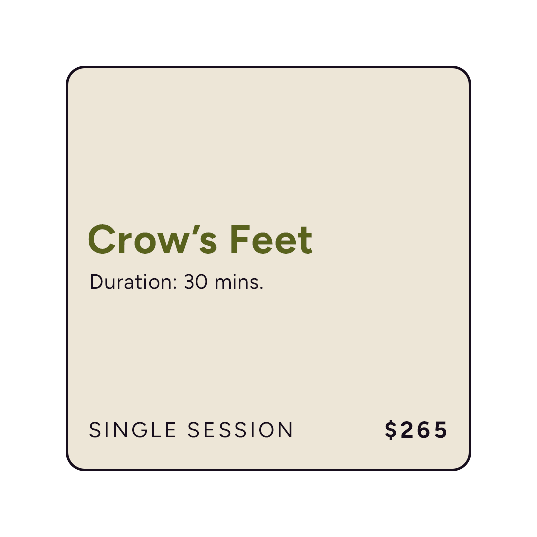 Plasma Lift+ Crows Feet