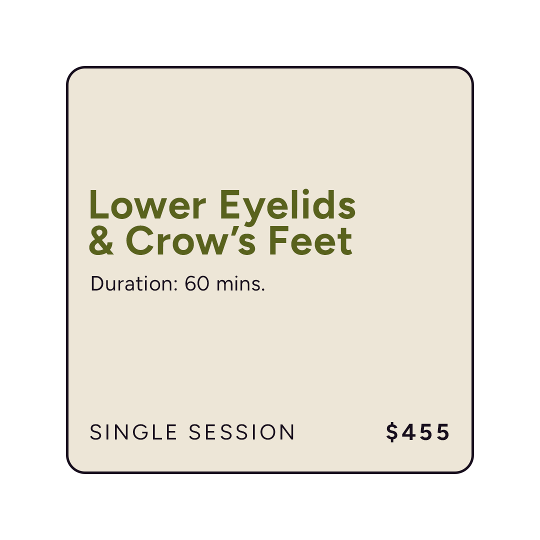 Plasma Lift+ Lower Eyelids & Crows Feet