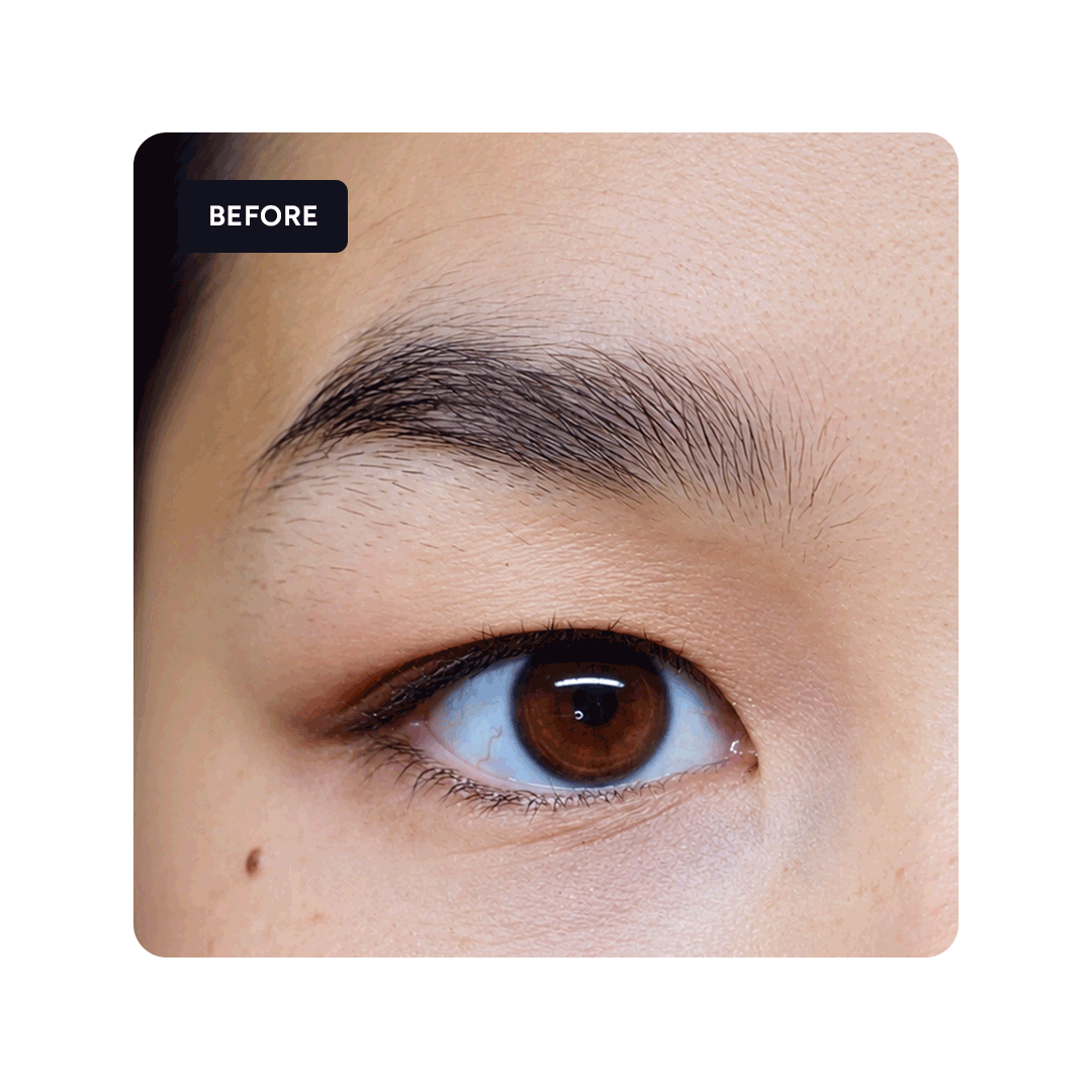 Brow Resurrection Soft Trial